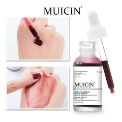Muicin-Peeling Solution Serum